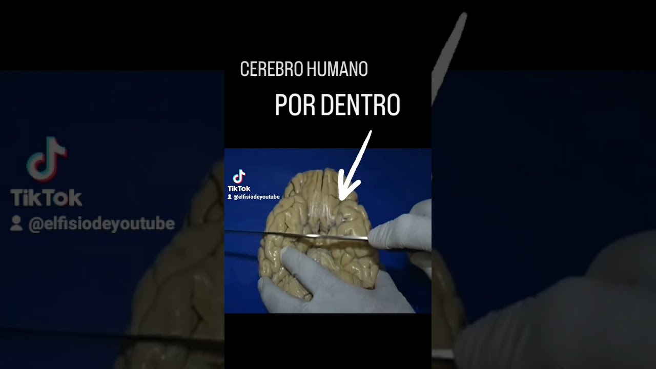 capa mas moderna evolutivamente del cerebro