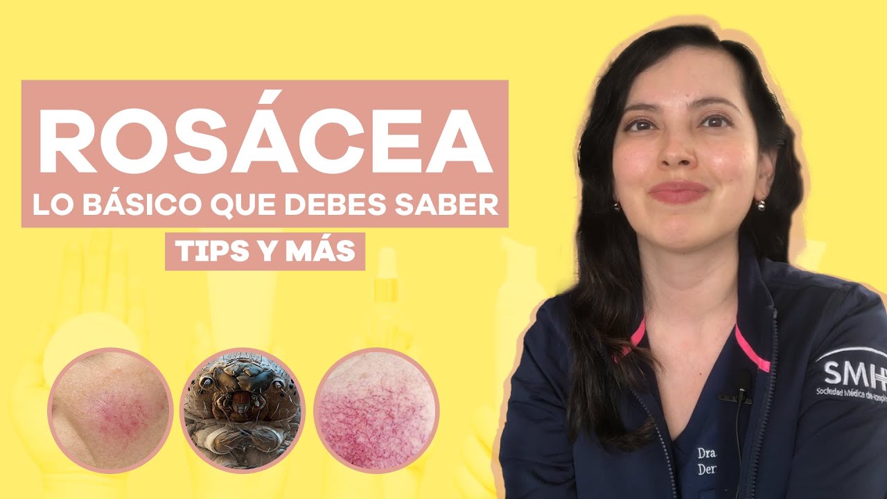 manchas rojas en las mejillas internas