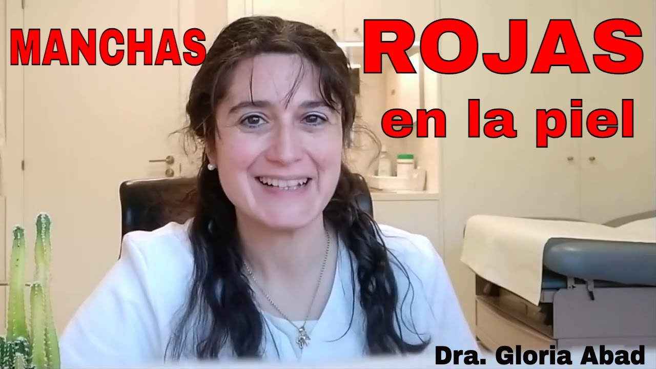 que pasa si te salen manchas rojas en la piel