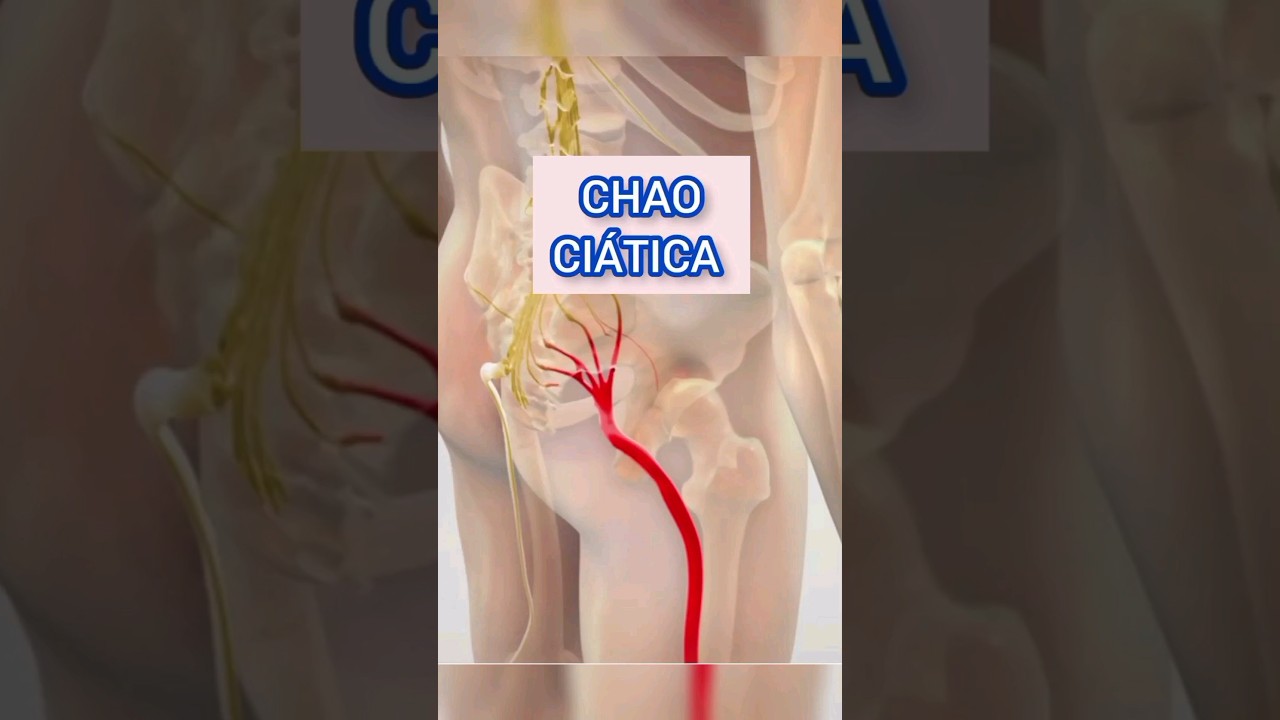 dolo neurobion inyectable para la ciatica
